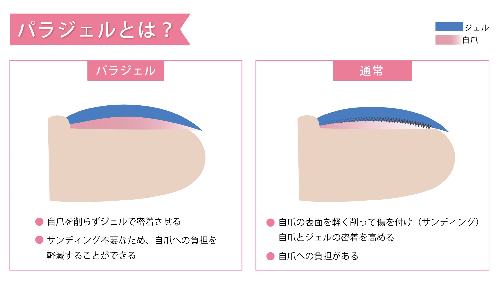 パラジェルの特徴を表すイメージイラスト