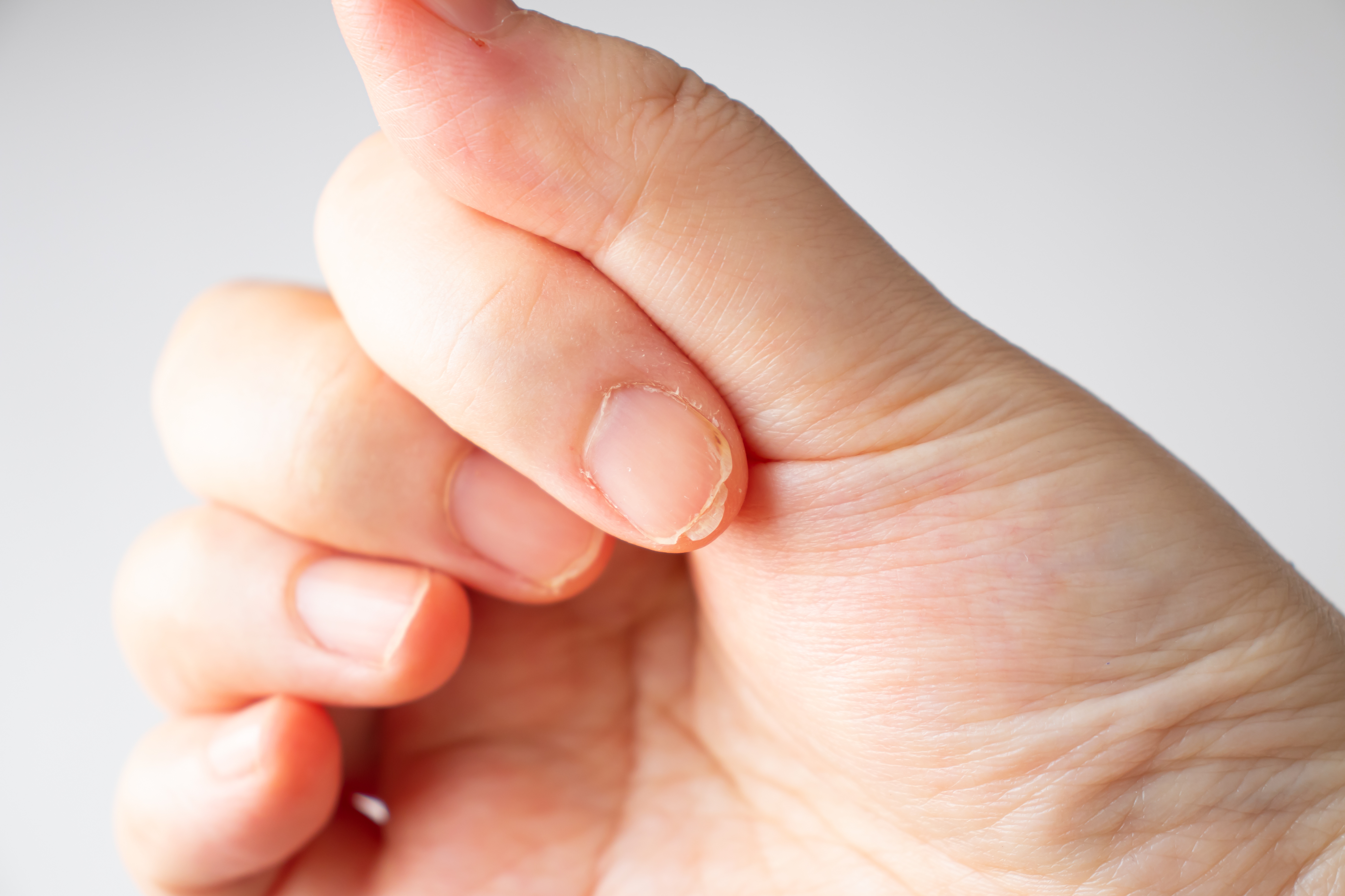 二枚爪のイメージ画像